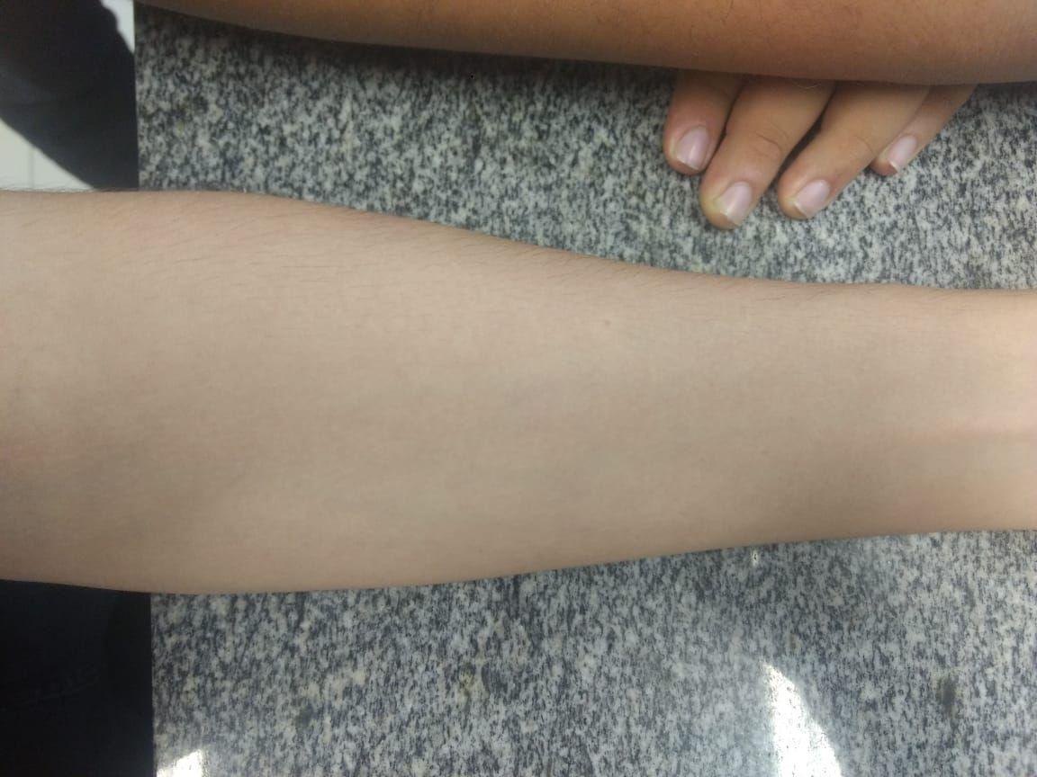 arm1