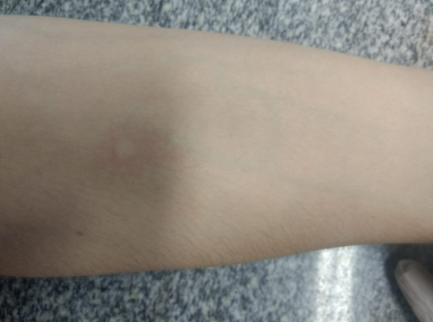 arm3